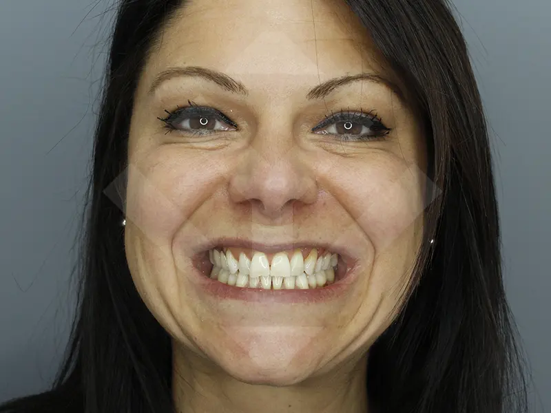 caso periodoncia antes