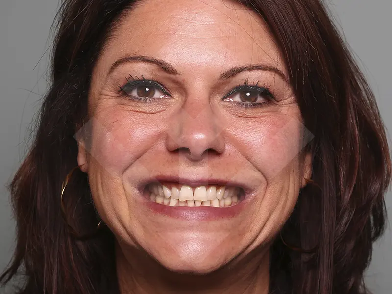 caso periodoncia después