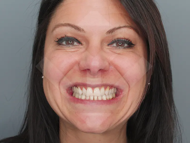 caso periodoncia antes